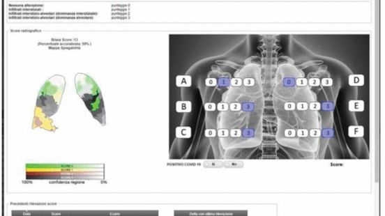 Assessing Trustworthy AI in times of COVID-19. Deep Learning for predicting a multi-regional score&nbsp;conveying the degree of lung compromise in&nbsp;COVID-19 patients